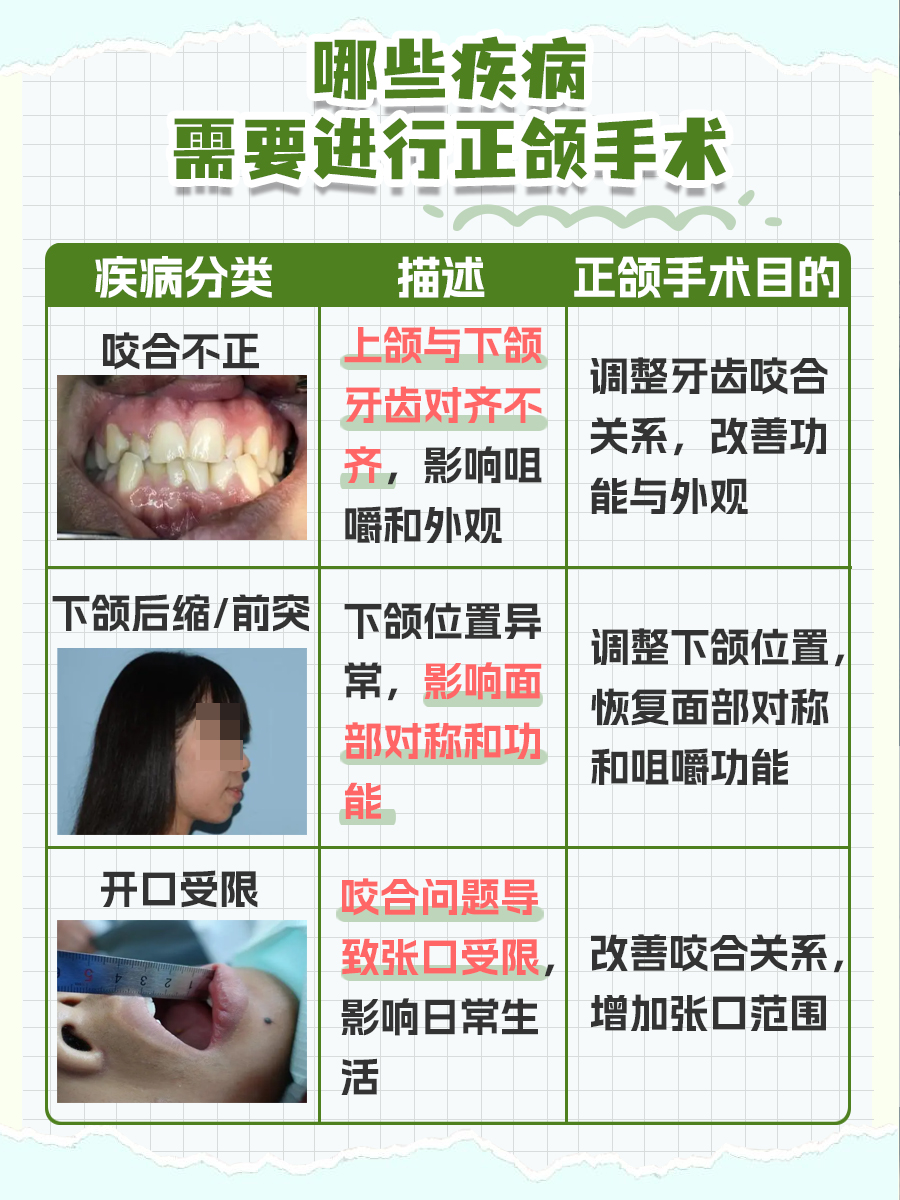 探究：正颌手术风险知多少？