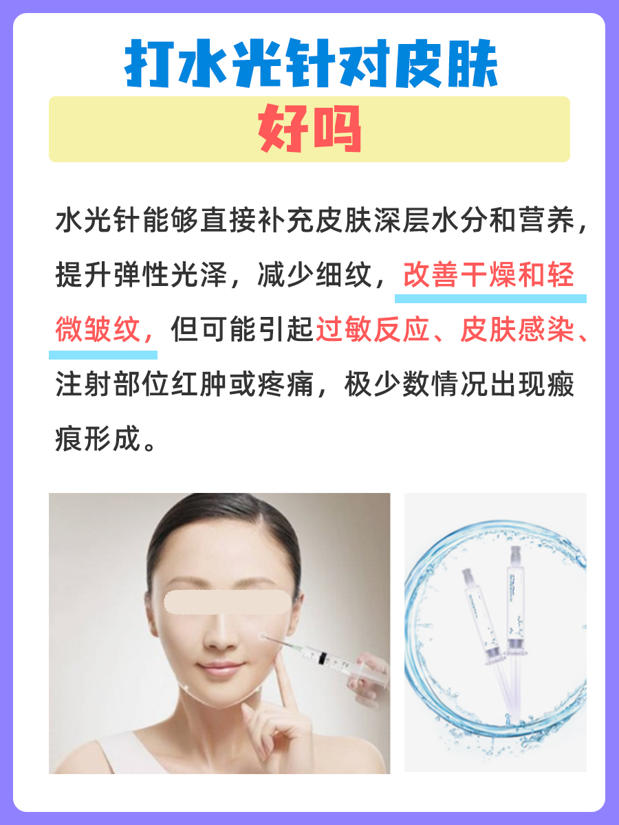 打水光针对皮肤好不好,一文了解