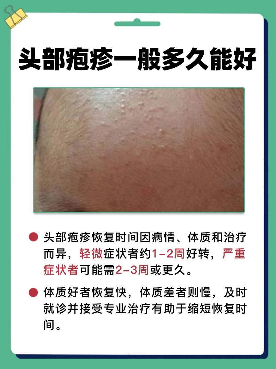 头部疱疹一般多久能好？看完就知道了