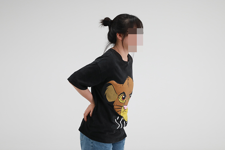 腰背部肌筋膜炎位置图