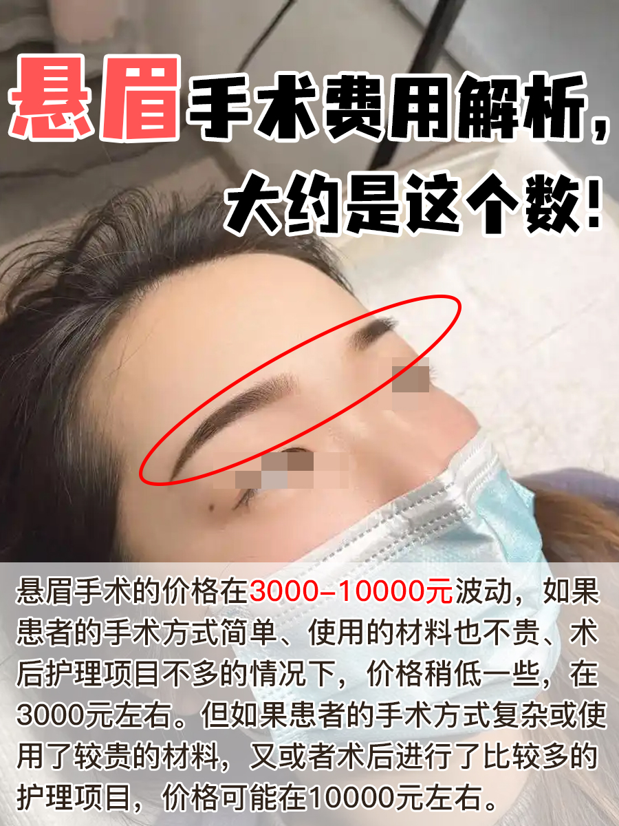 悬眉手术费用解析，大约是这个数！