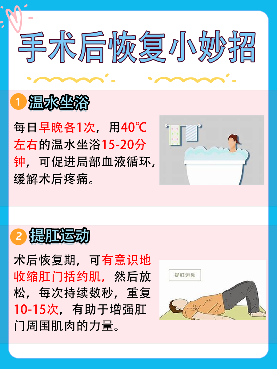 痔疮手术：方法有几种？哪种最好？