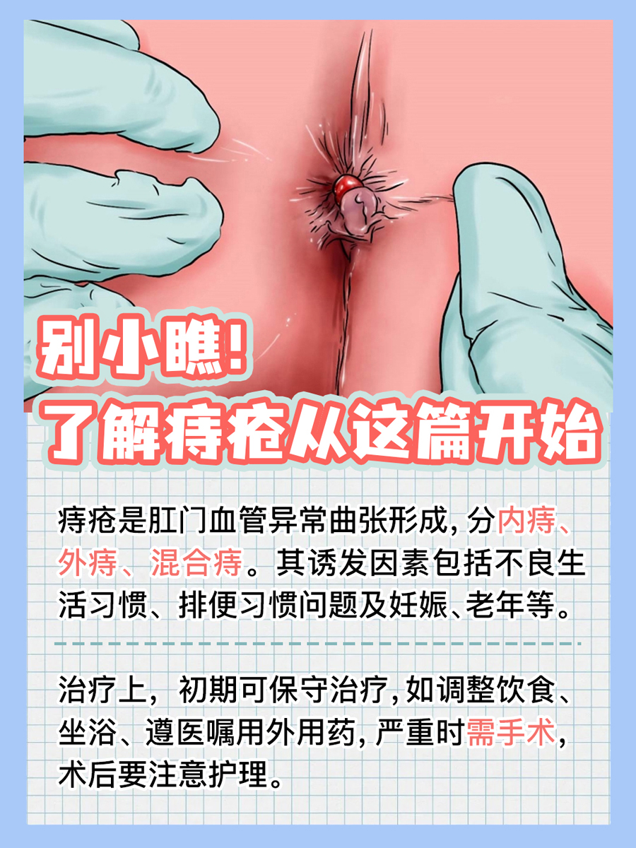 别小瞧!了解痔疮从这篇开始