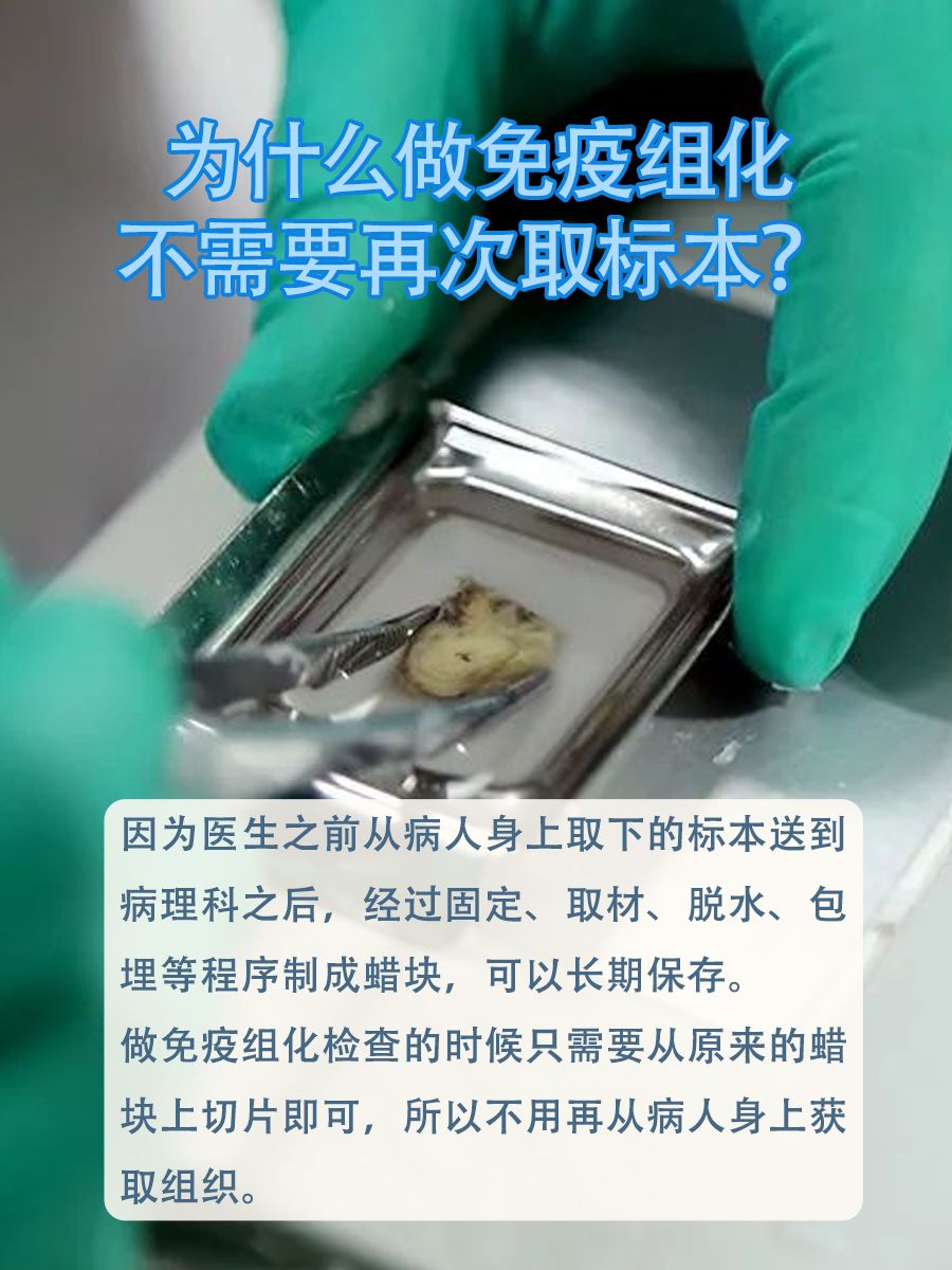 什么是免疫组化检查？看完这个你就懂了