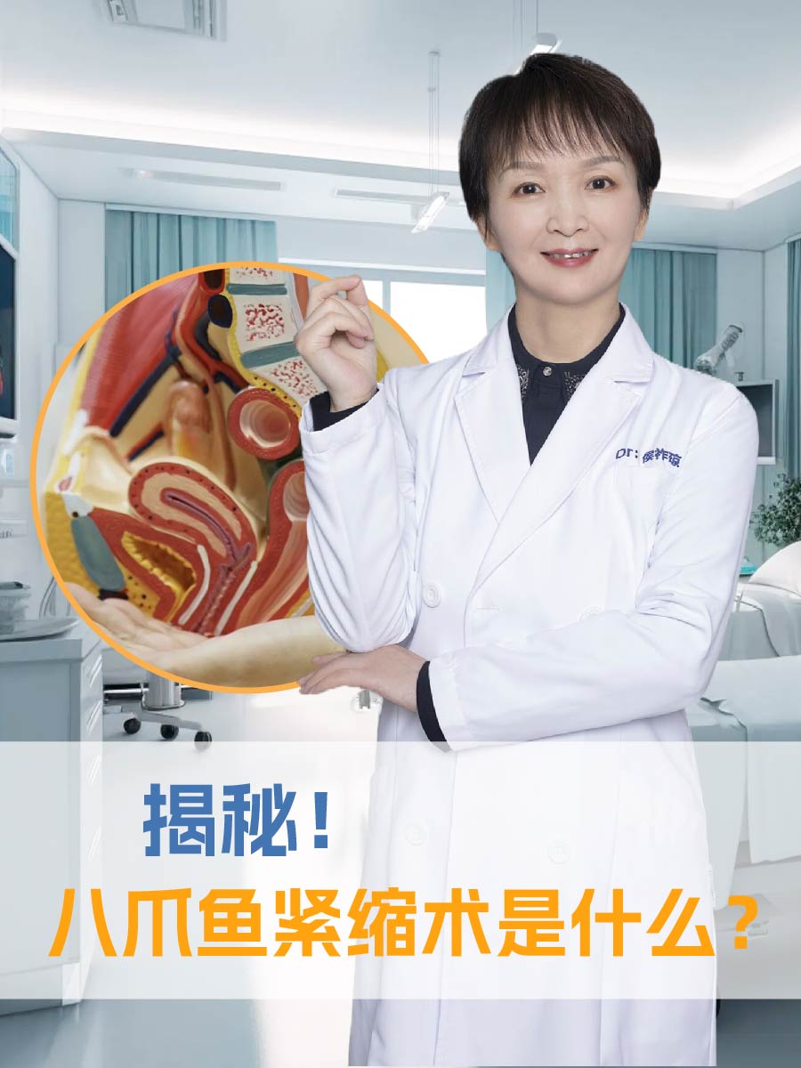 揭秘！八爪鱼紧缩术是什么？