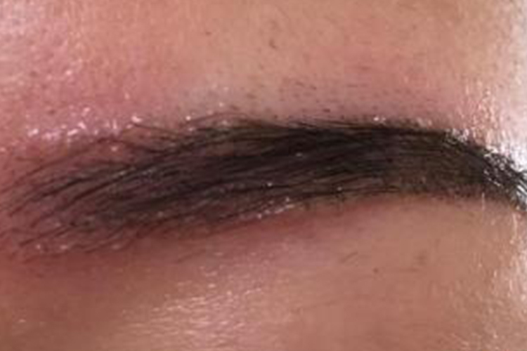 纹眉术后红肿图