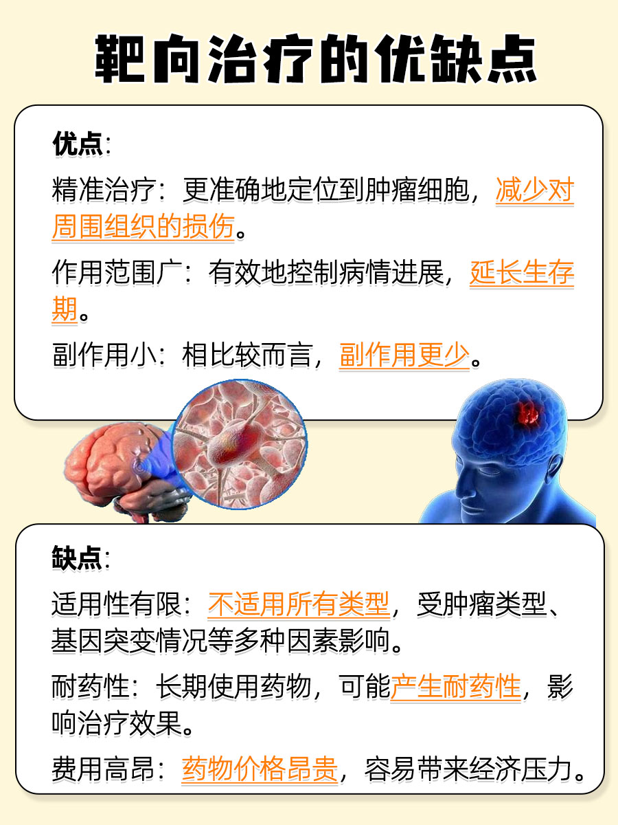 脑部胶质肿瘤能治好吗？来听听医生的说法