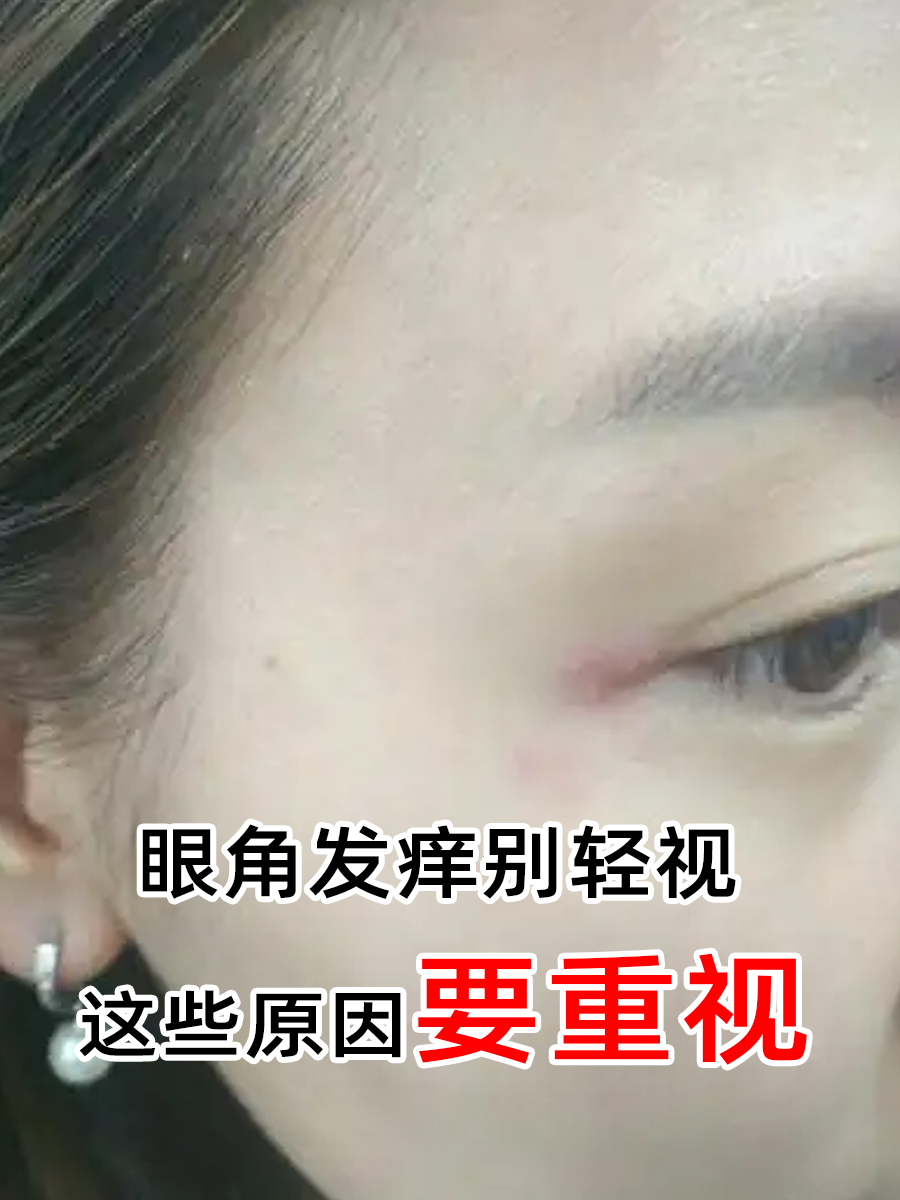 眼角发痒别轻视，这些原因要重视