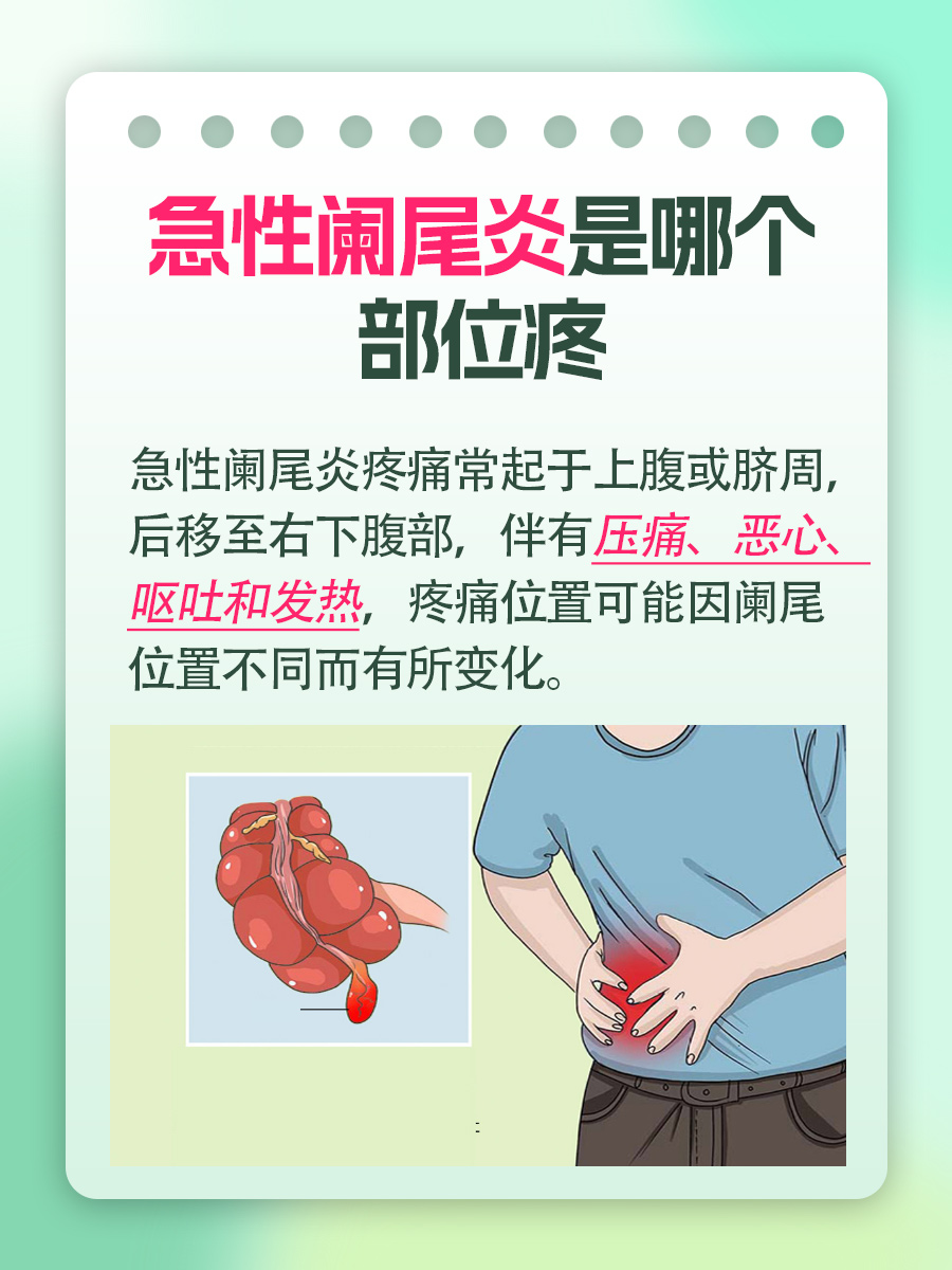 急性阑尾炎疼痛部位识别：究竟哪里会疼