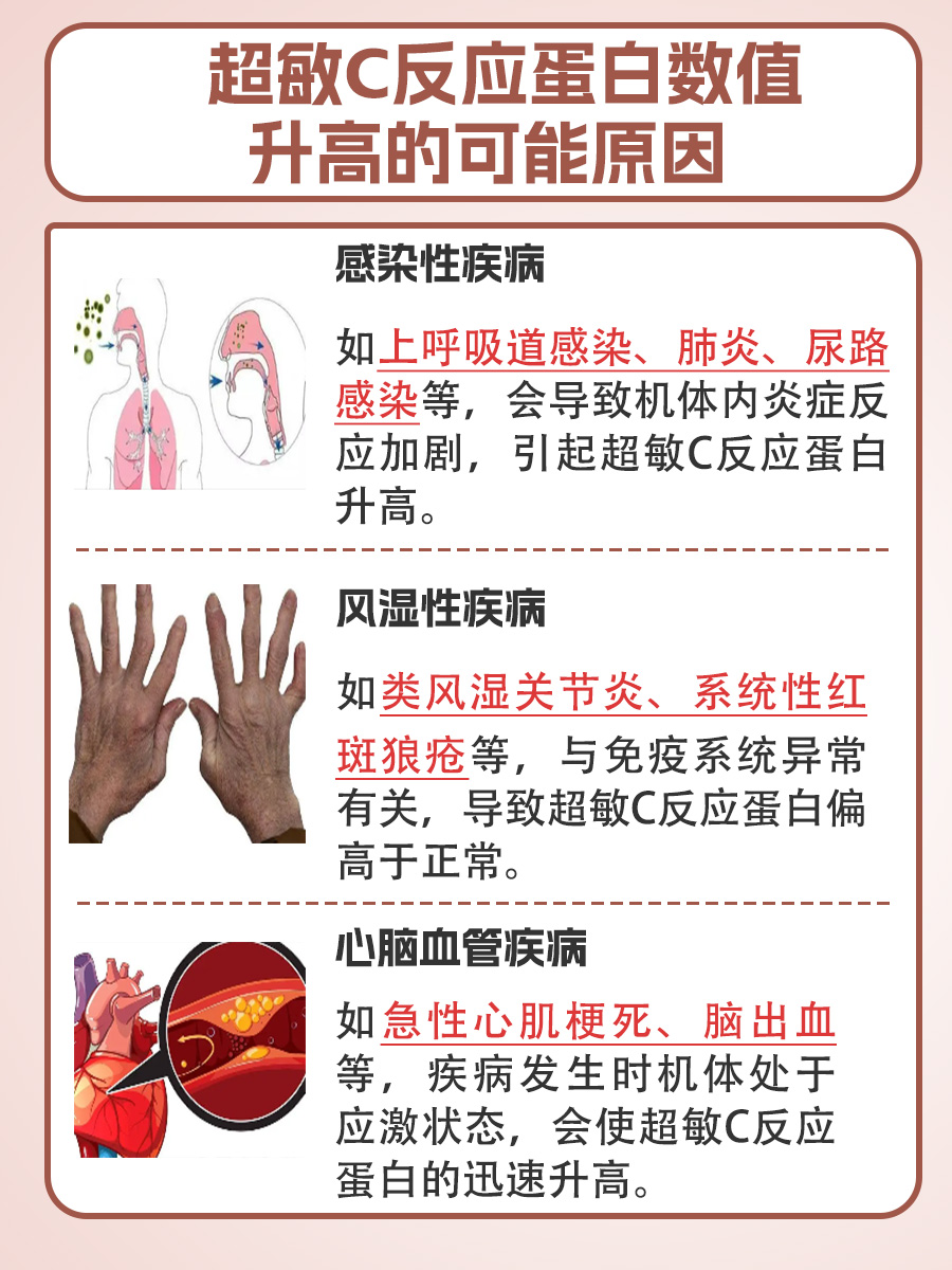 查看：超敏C反应蛋白正常值是多少？