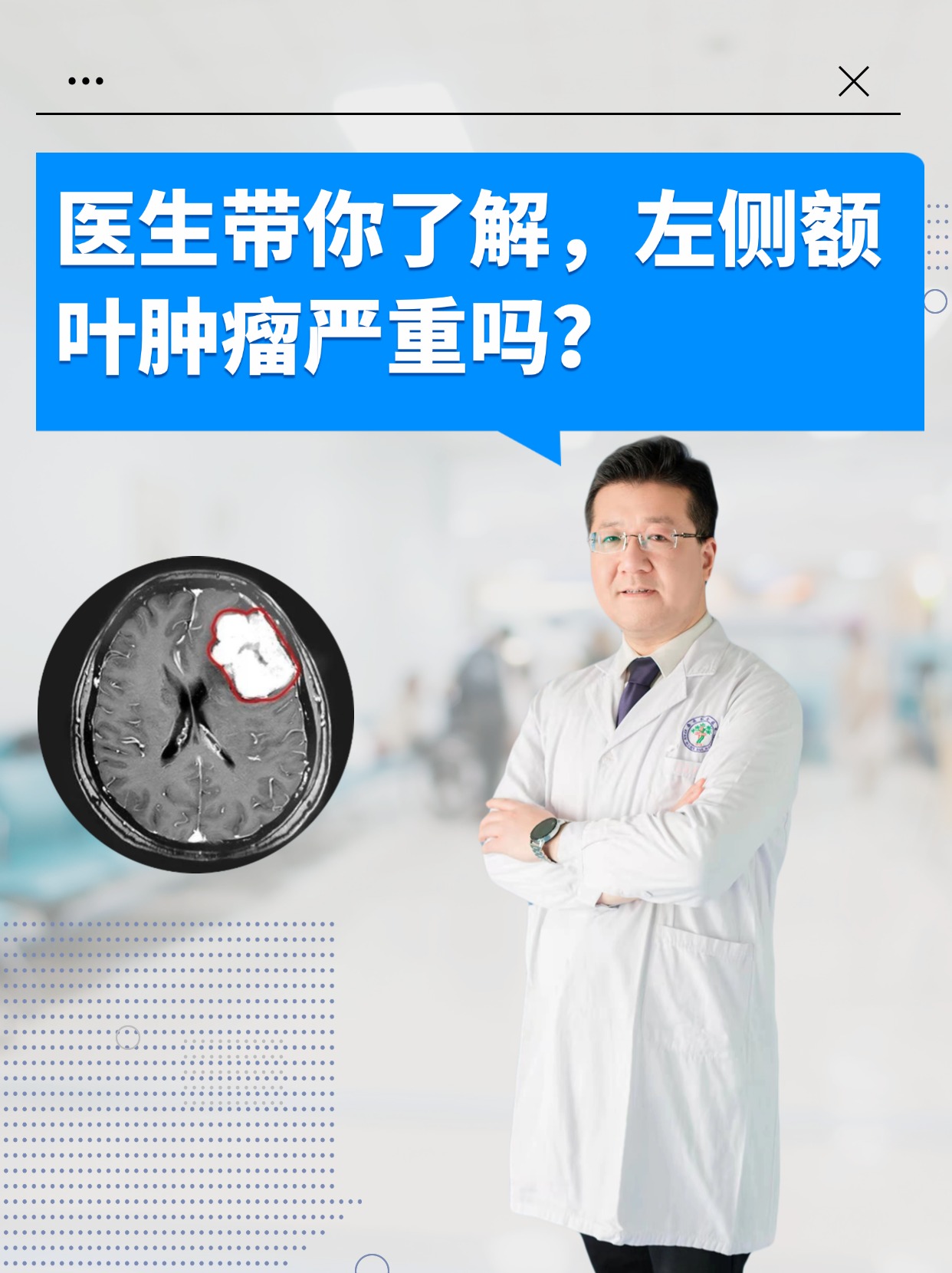 医生带你了解，左侧额叶肿瘤严重吗？