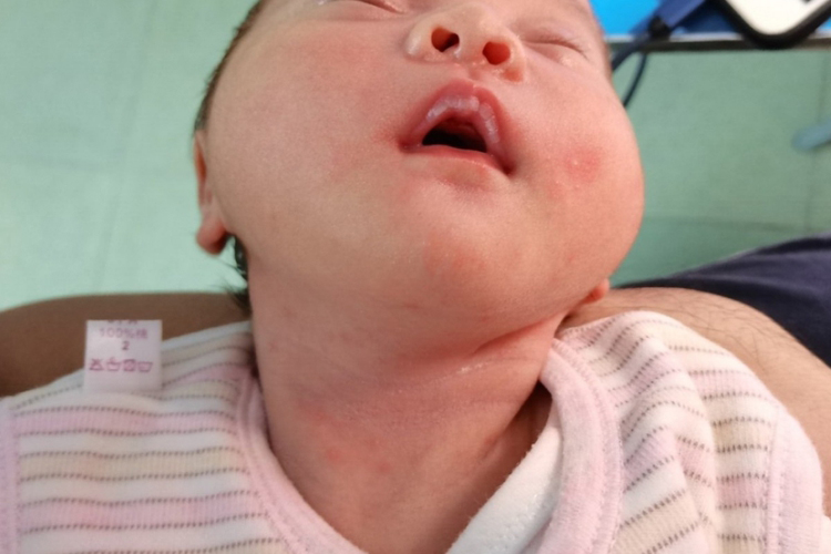 婴儿嘴唇苍白图 婴儿嘴唇苍白图