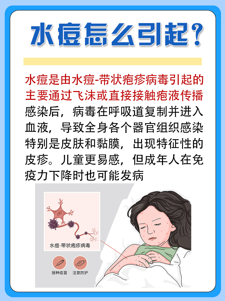 水痘怎么引起的？医生为你解答