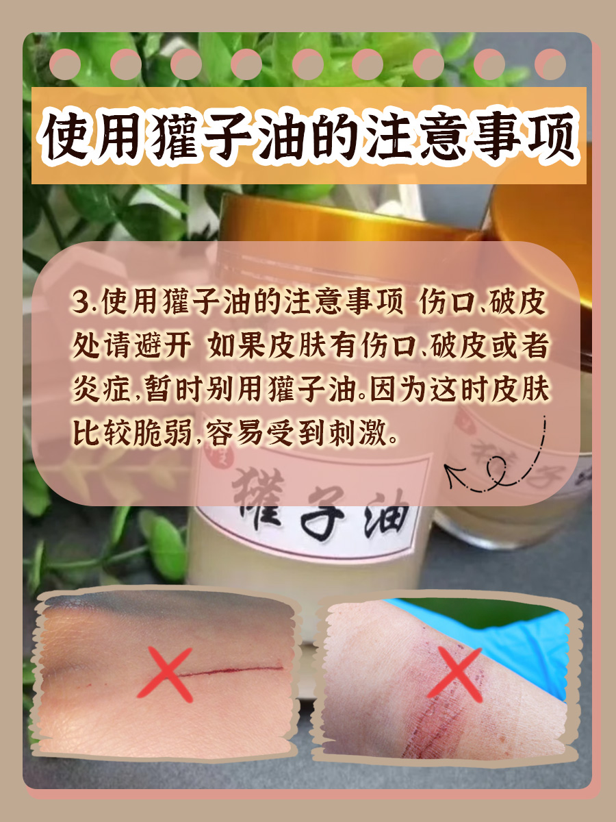 解锁獾子油功效与作用：美容养生常备良品！