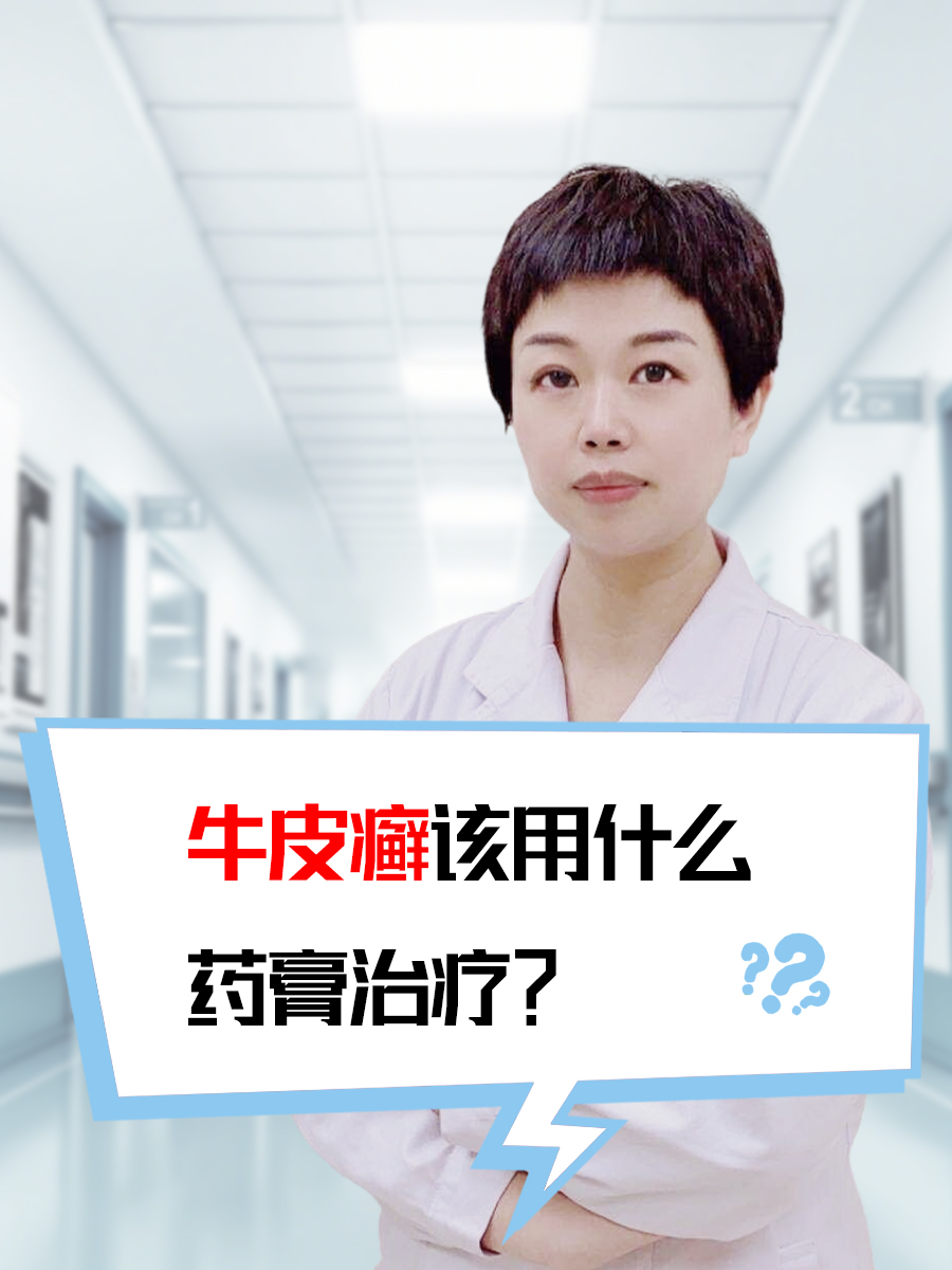 牛皮癣该用什么药膏治疗?