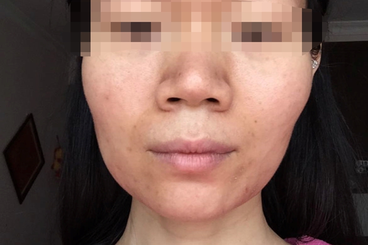 肾气虚面部症状图