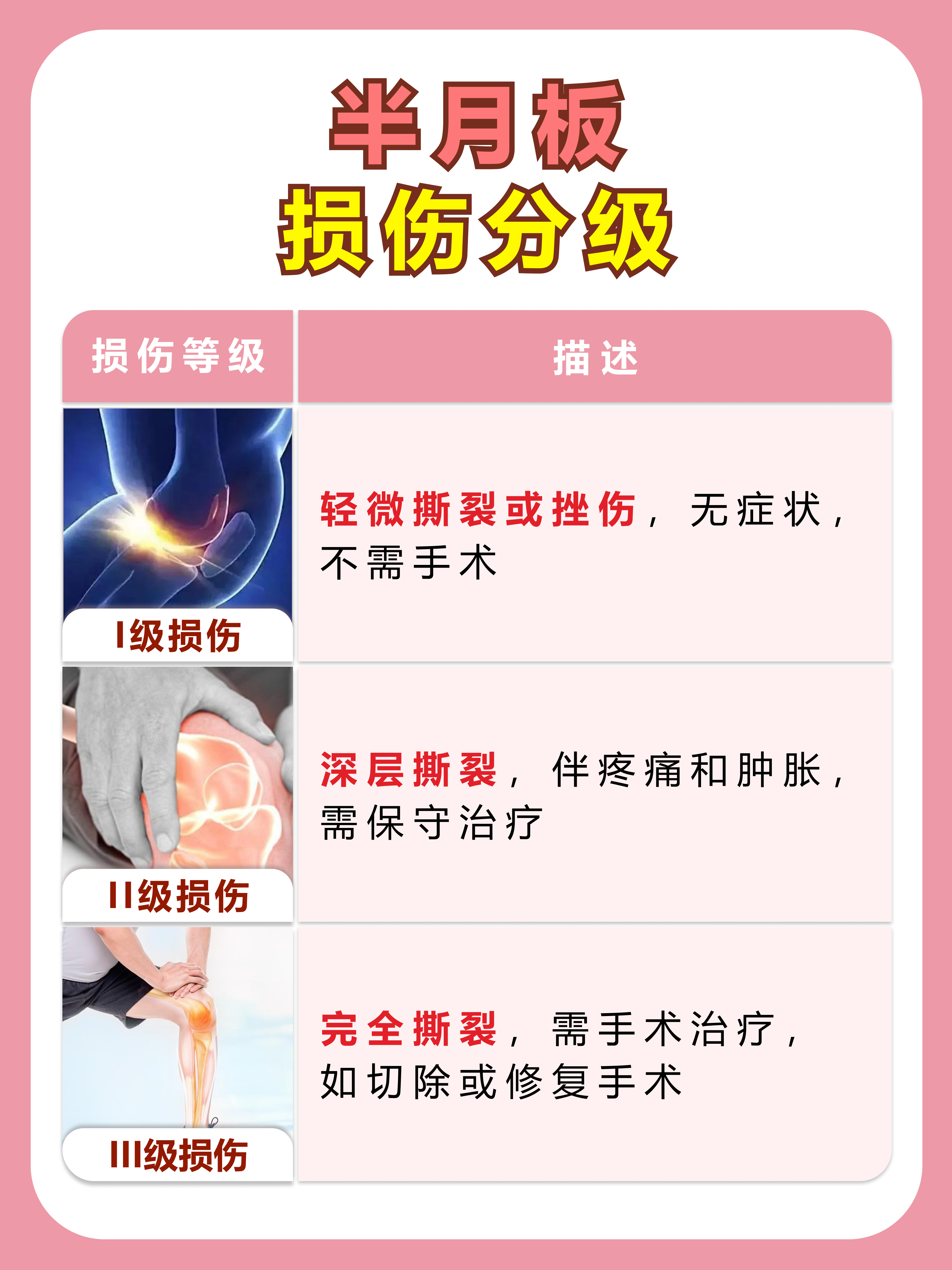 半月板损伤分级详解，了解你的状况！