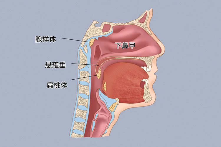 正常腺样体与腺样体肥大对比图