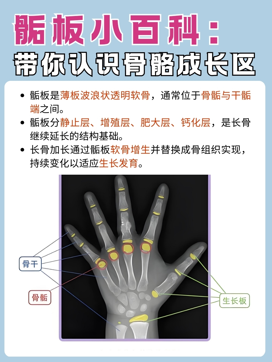 骺板知识帖:骨骼生长的神奇之处