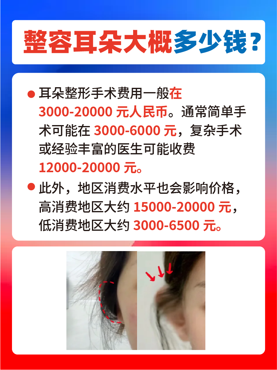 整容耳朵需要多少钱？费用大公开！