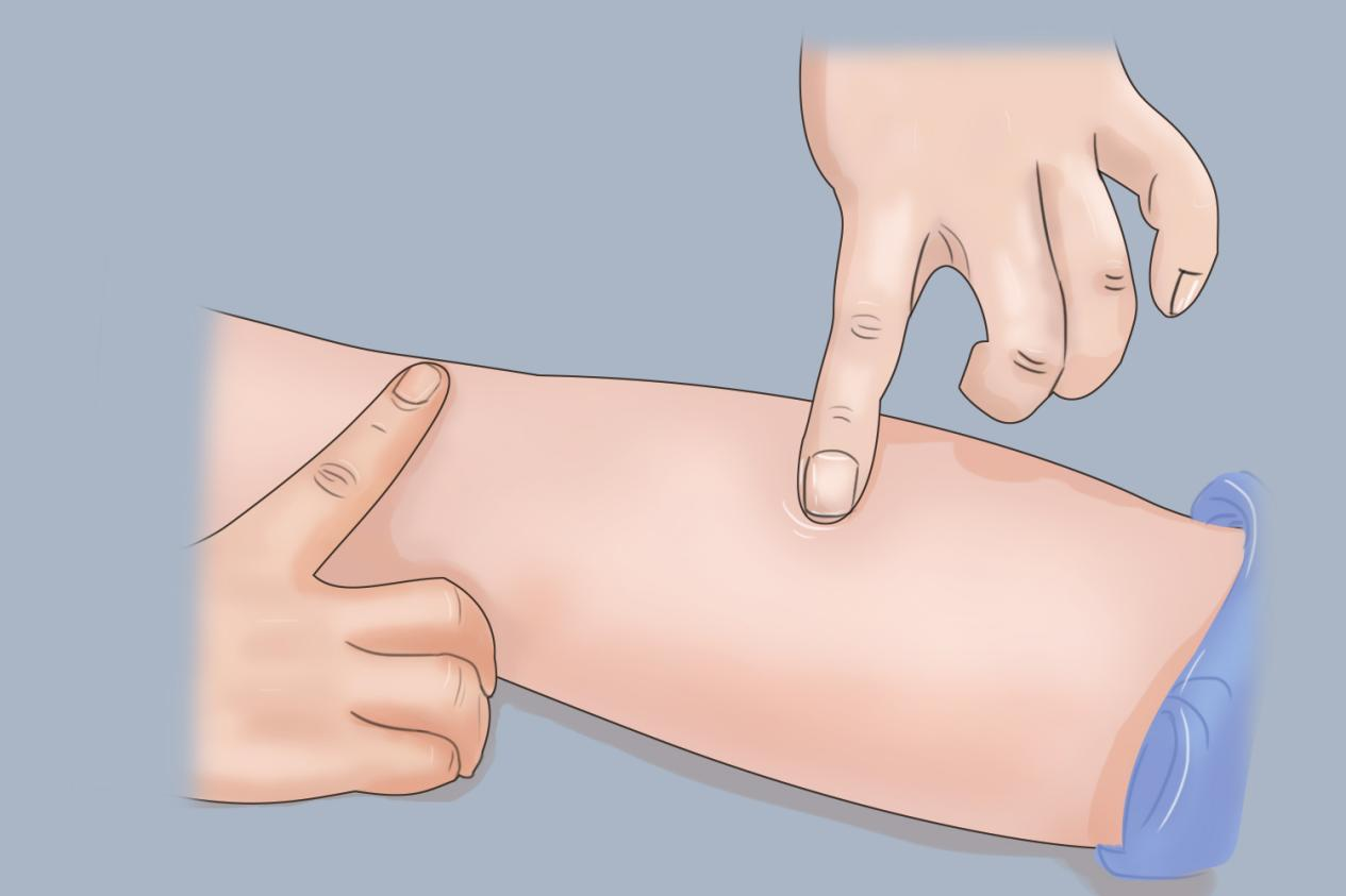 暴露注射部位图