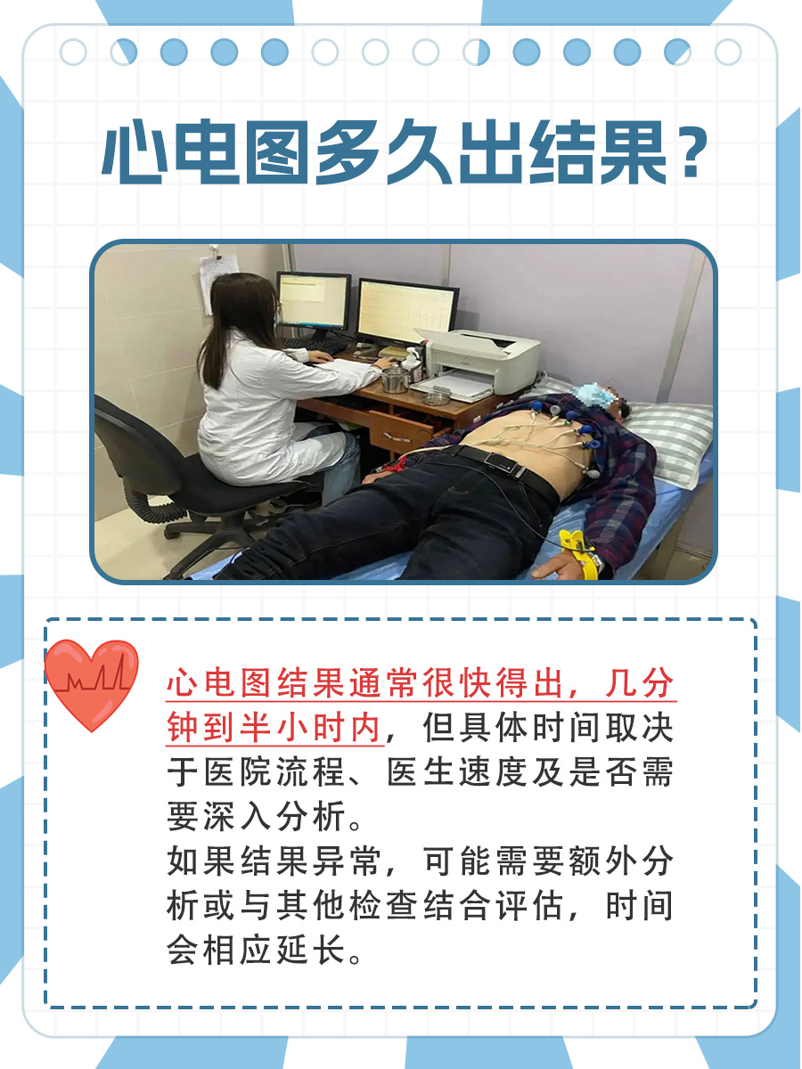 关注心脏健康，心电图多久出结果