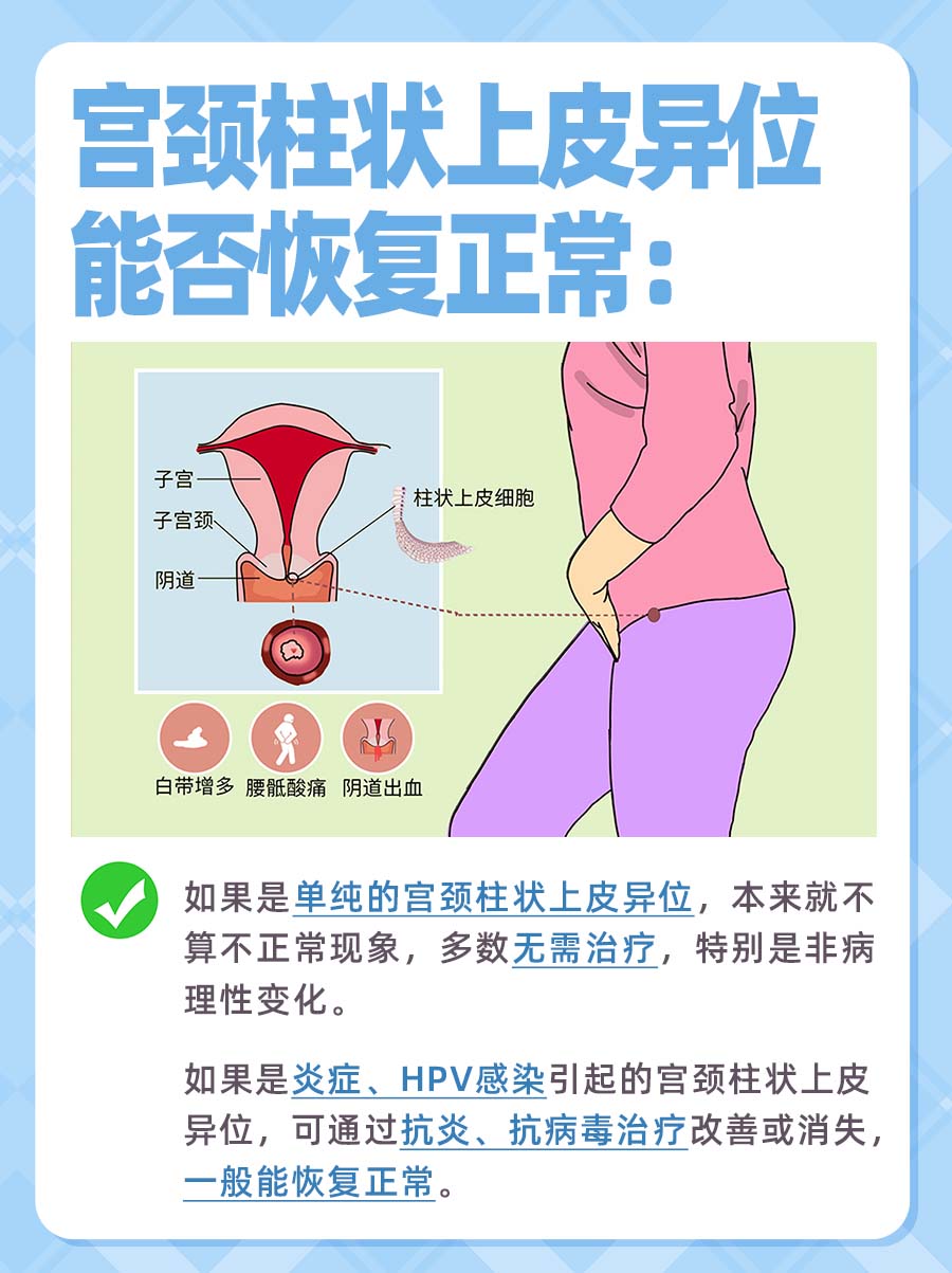 宫颈柱状上皮异位能恢复正常吗？医生告诉你