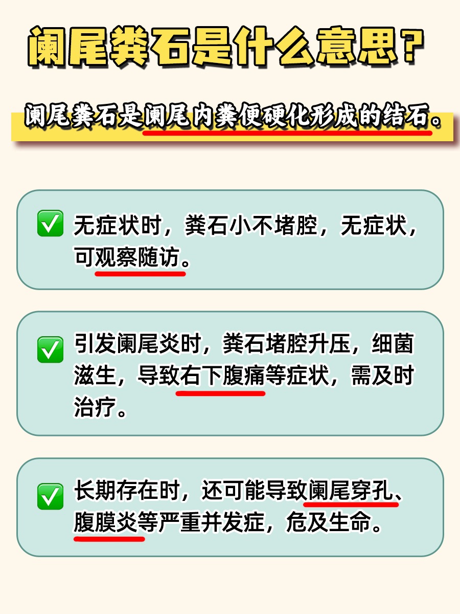 阑尾里的不速之客：阑尾粪石，你了解多少？