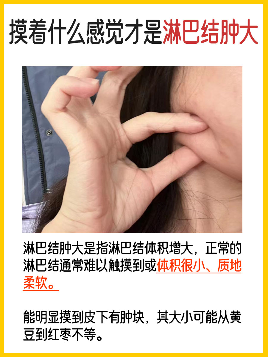 揭秘：摸着什么感觉才是淋巴结肿大