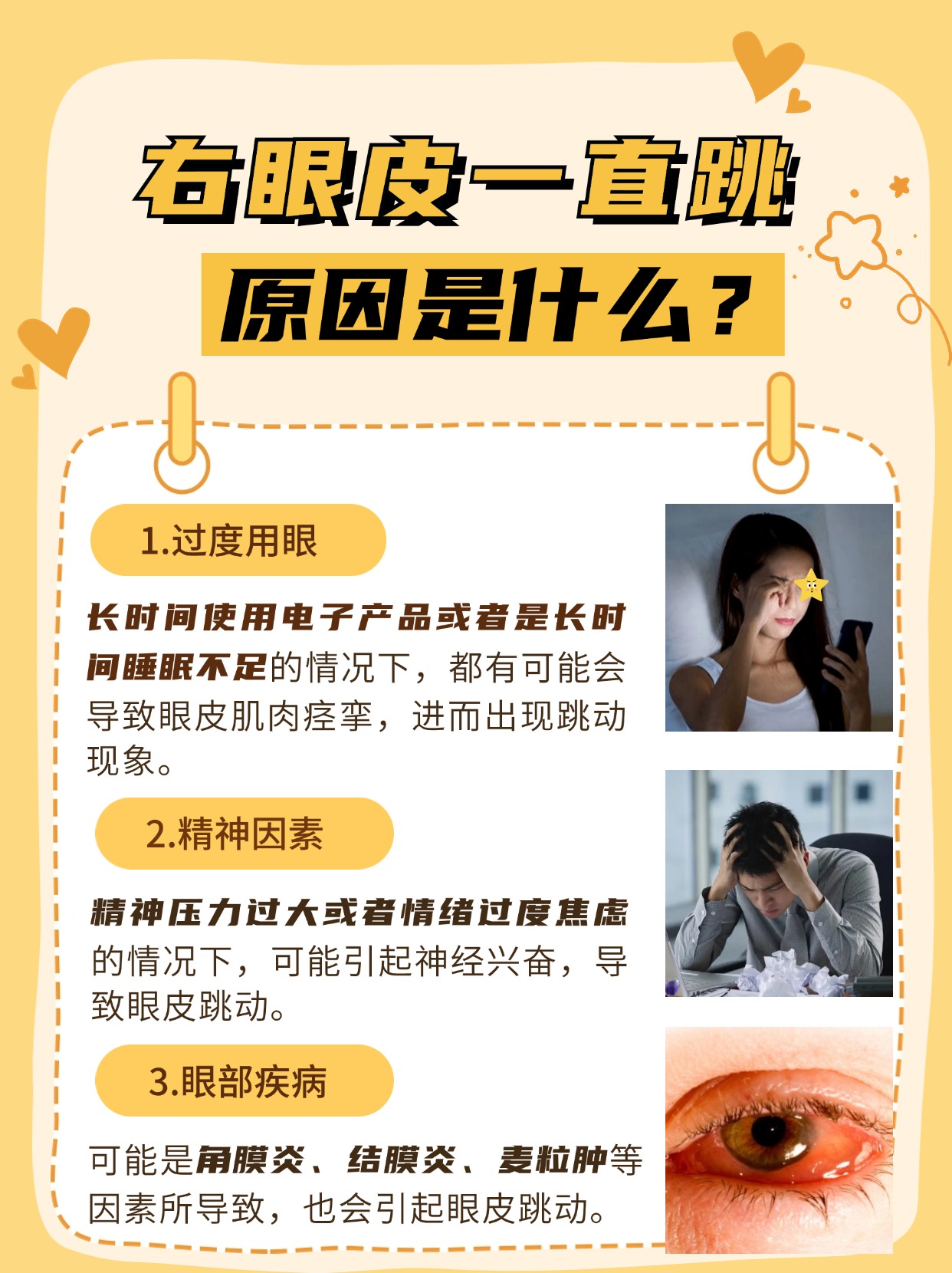 右眼皮一直跳什么预兆,医生辟谣!