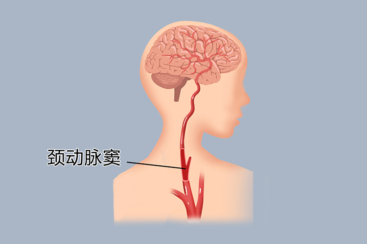 颈动脉的准确位置图片图片