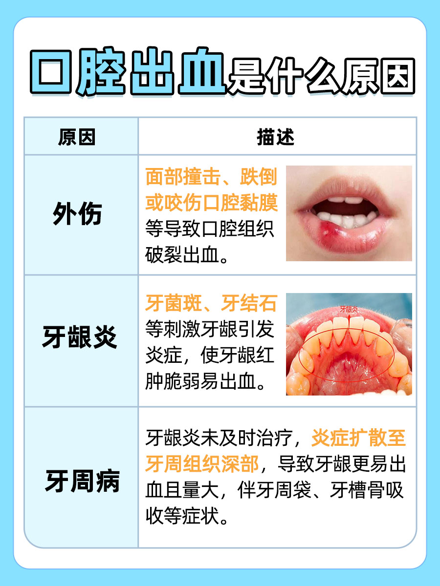 原因解析：口腔出血是什么原因