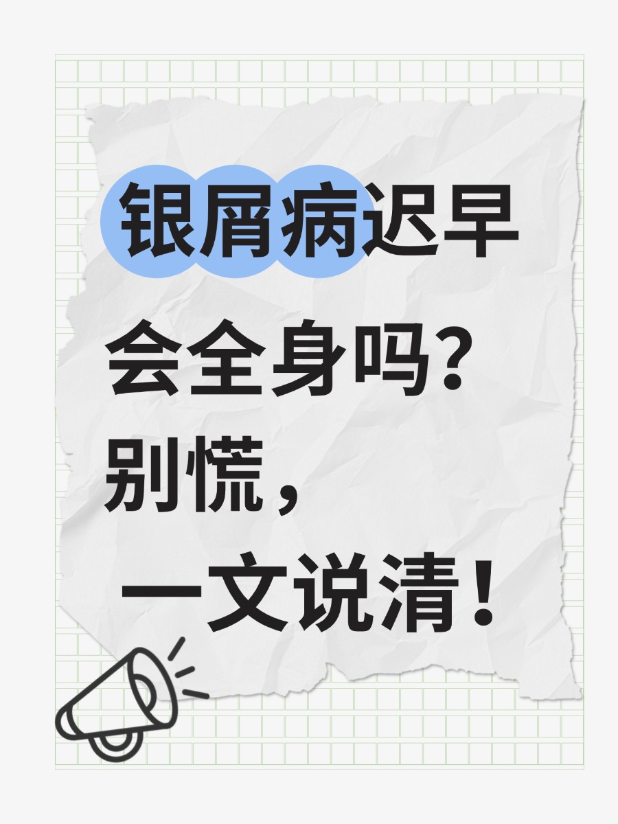 银屑病迟早会全身吗?别慌,一文说清!