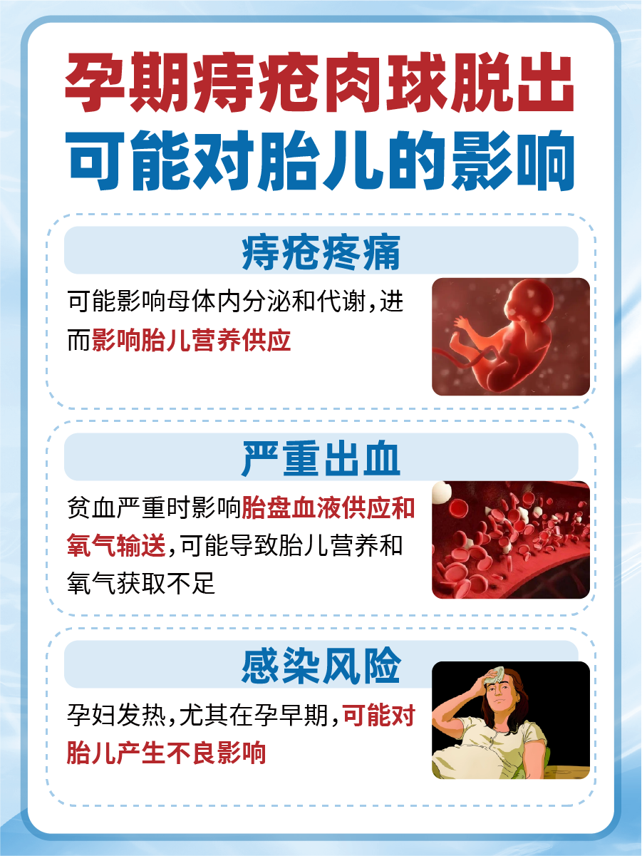 孕期痔疮脱出?这些方法来应对