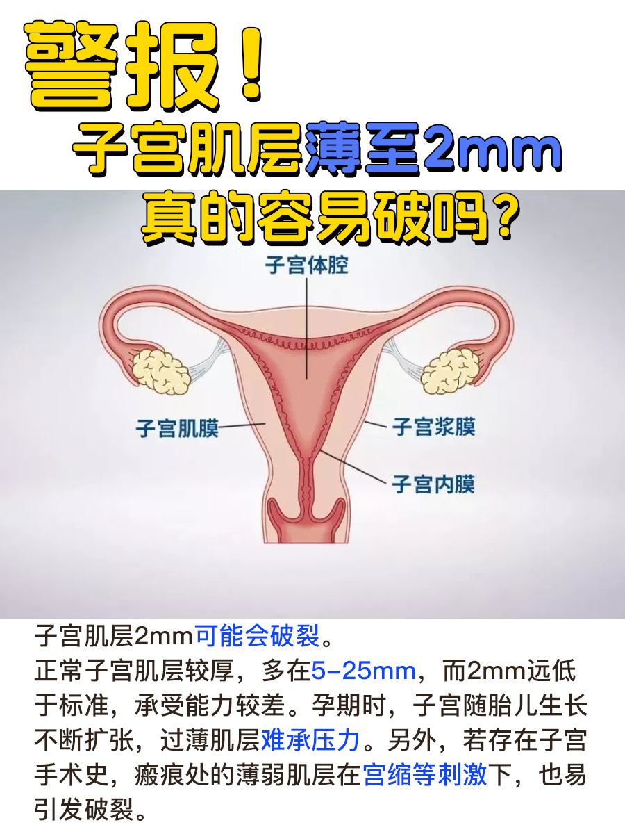 警报！子宫肌层薄至2mm，真的容易破吗？