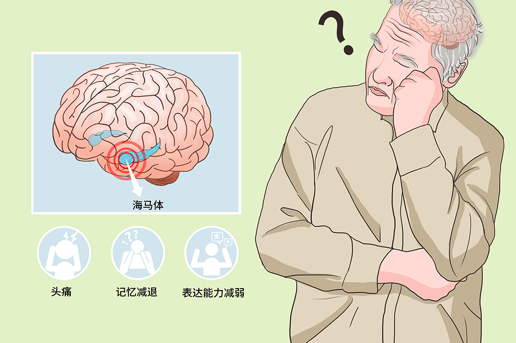 记忆力减退人群图