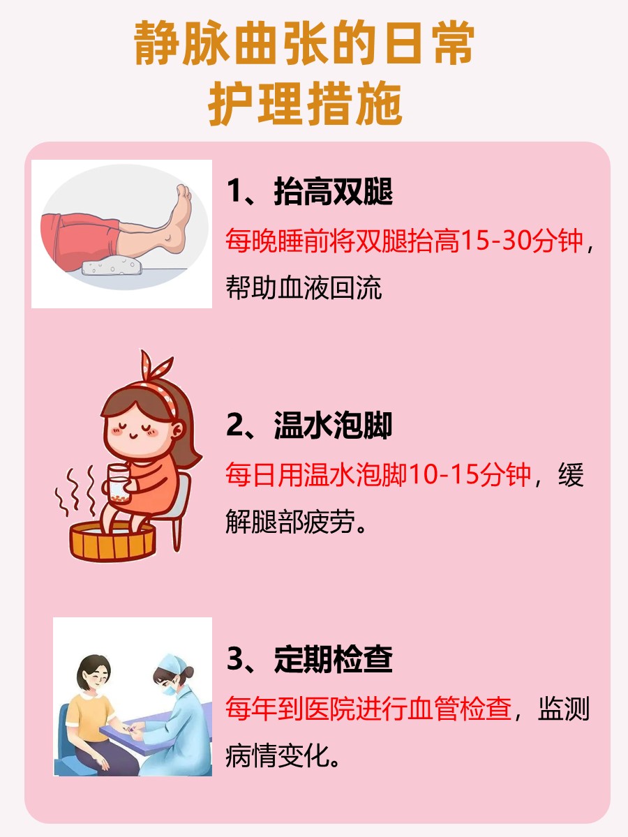 静脉曲张药物治疗推荐，这种药物更有效