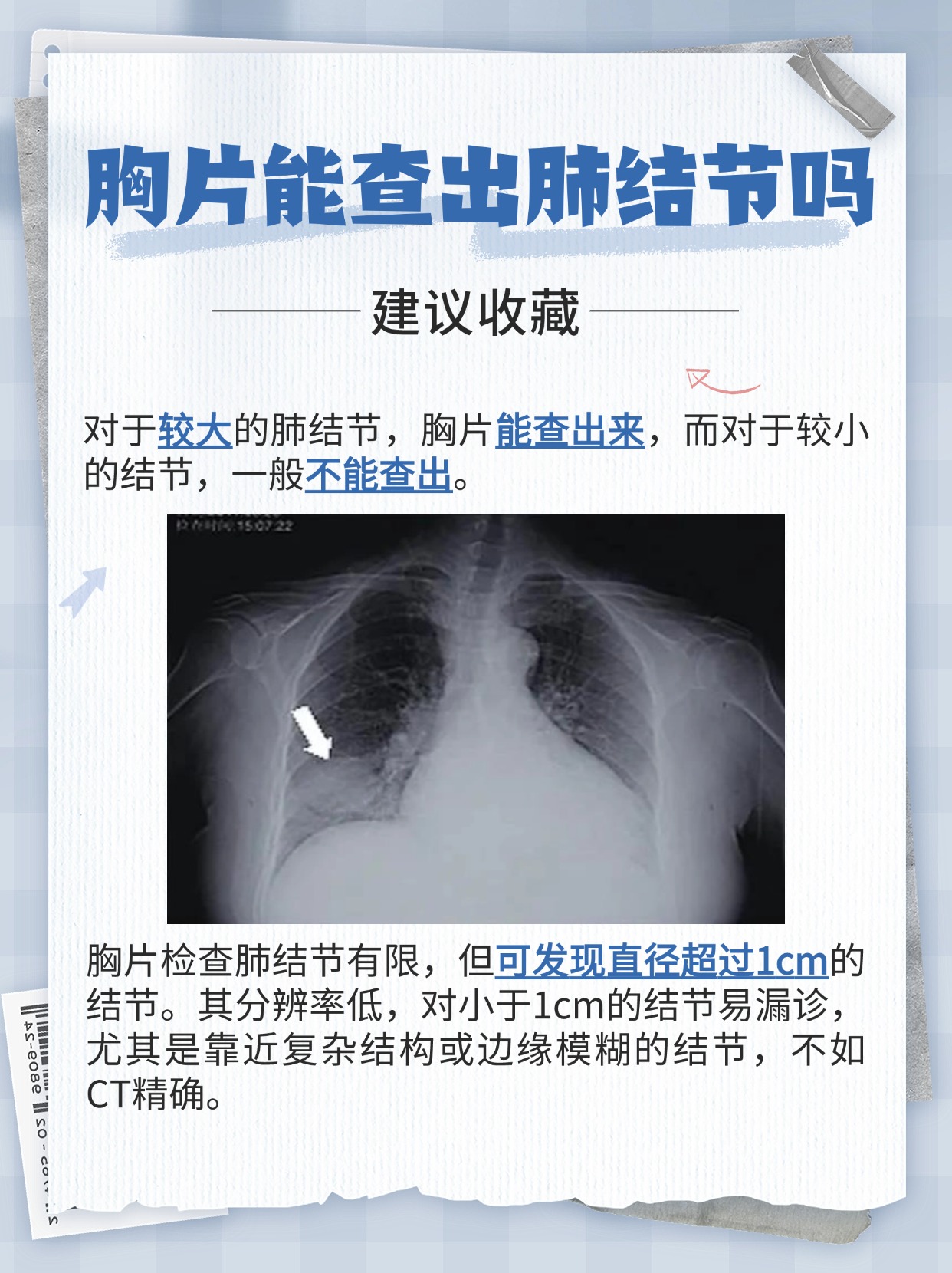 胸片能查出肺结节吗，答案揭晓