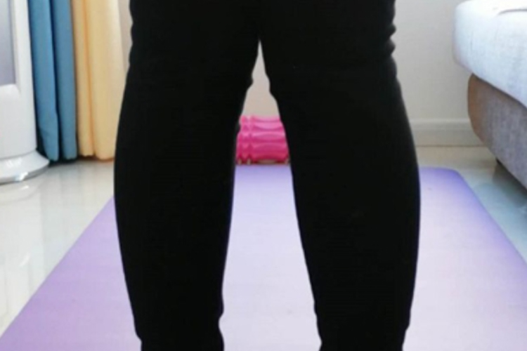 小孩膝盖内扣小腿外翻图