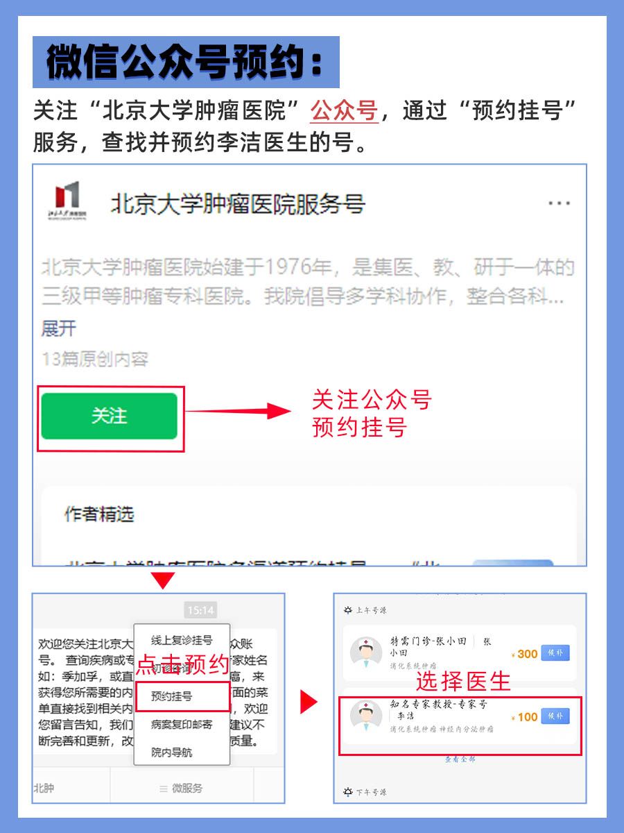 北京肿瘤医院李洁医生怎么样？怎么挂号？
