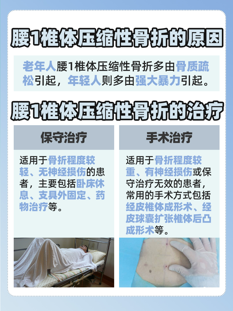 医生全解析：腰1椎体压缩性骨折的原因和治疗