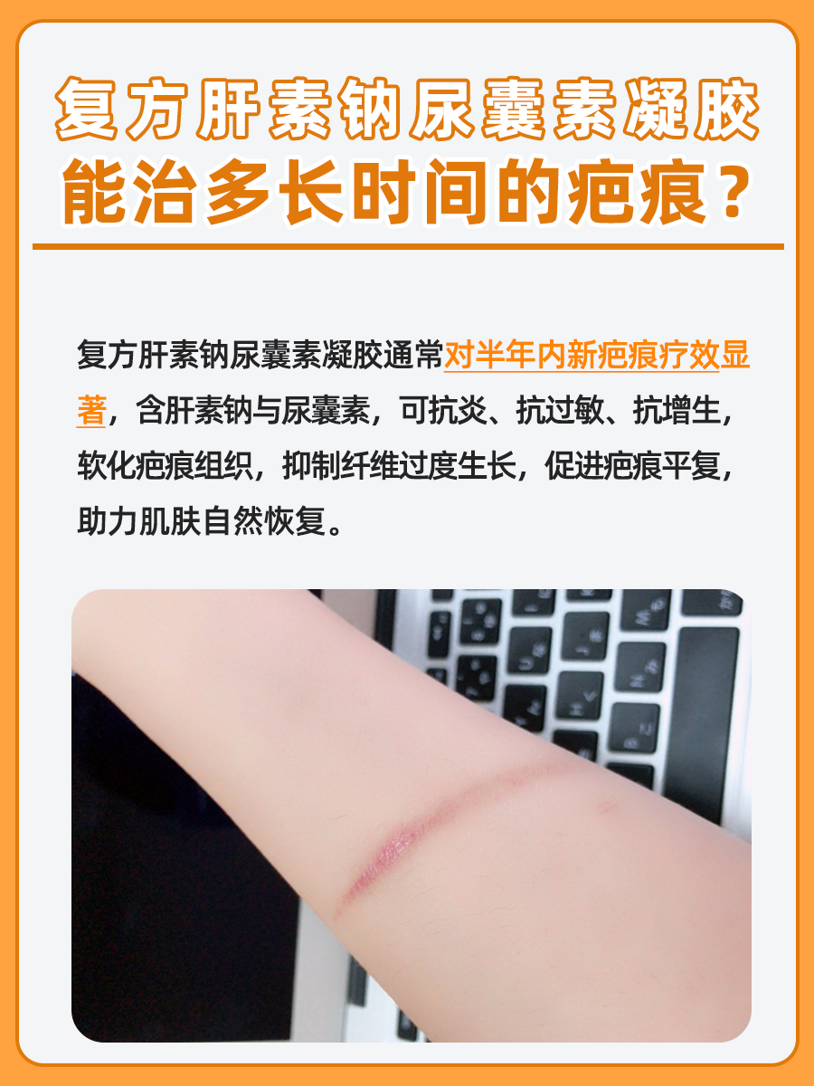 探究：复方肝素钠尿囊素凝胶能治多久的疤痕？