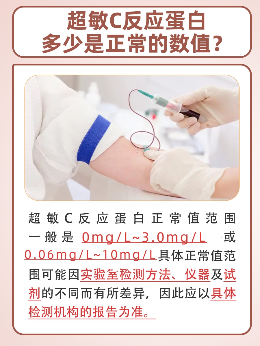 查看：超敏C反应蛋白正常值是多少？