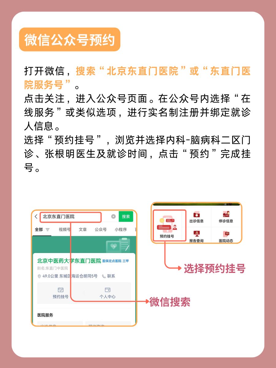 北京东直门医院张根明医生怎么样?怎么挂号?