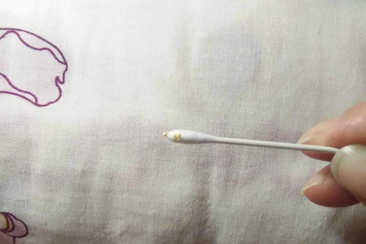 宝宝长的黄白色尿垢图