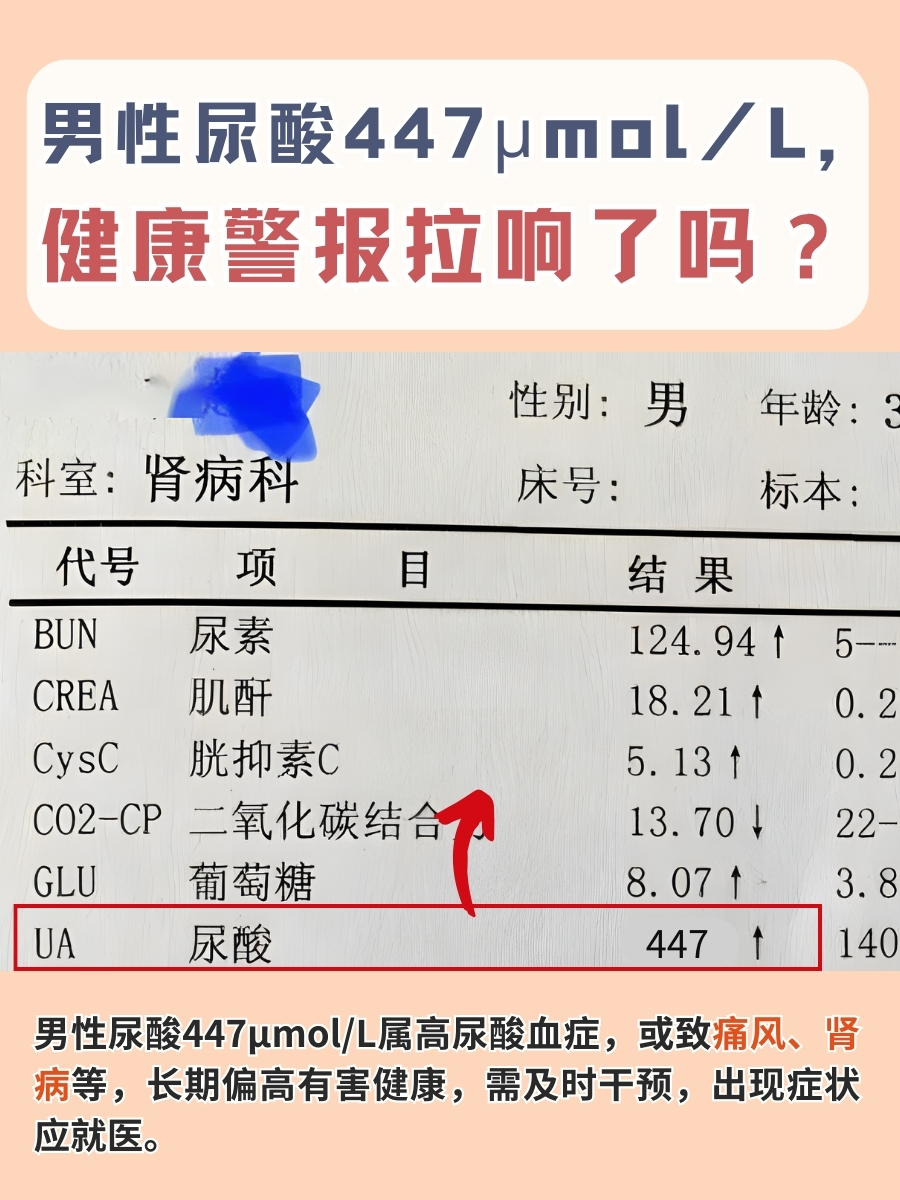 男性尿酸447μmol/L，健康警报拉响了吗？