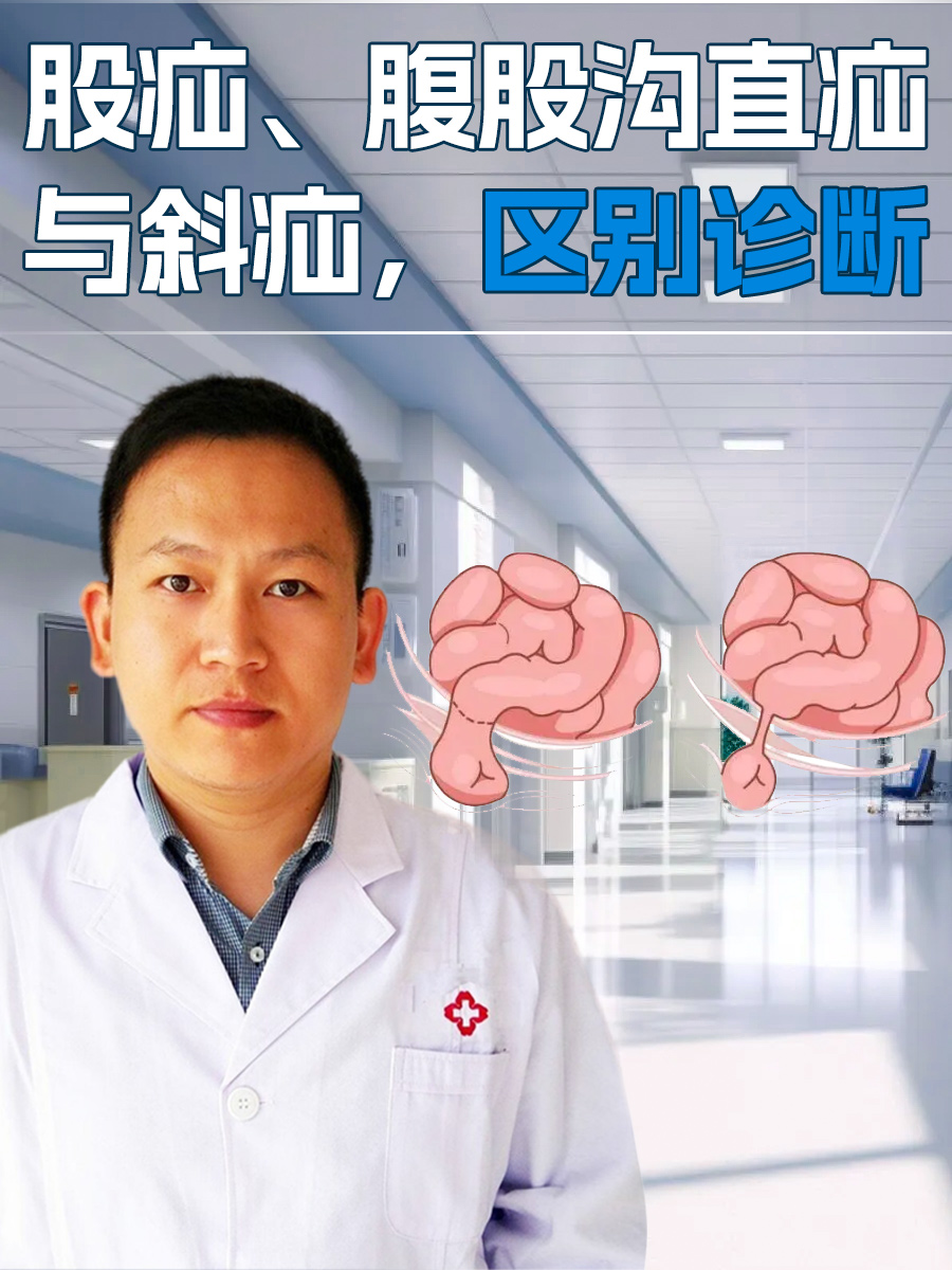 股疝、腹股沟直疝与斜疝，区别诊断