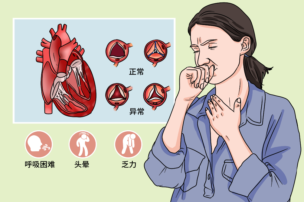 瓣膜病是由多種原因引起的心臟瓣膜狹窄或(和)關閉不全所致的心臟疾病