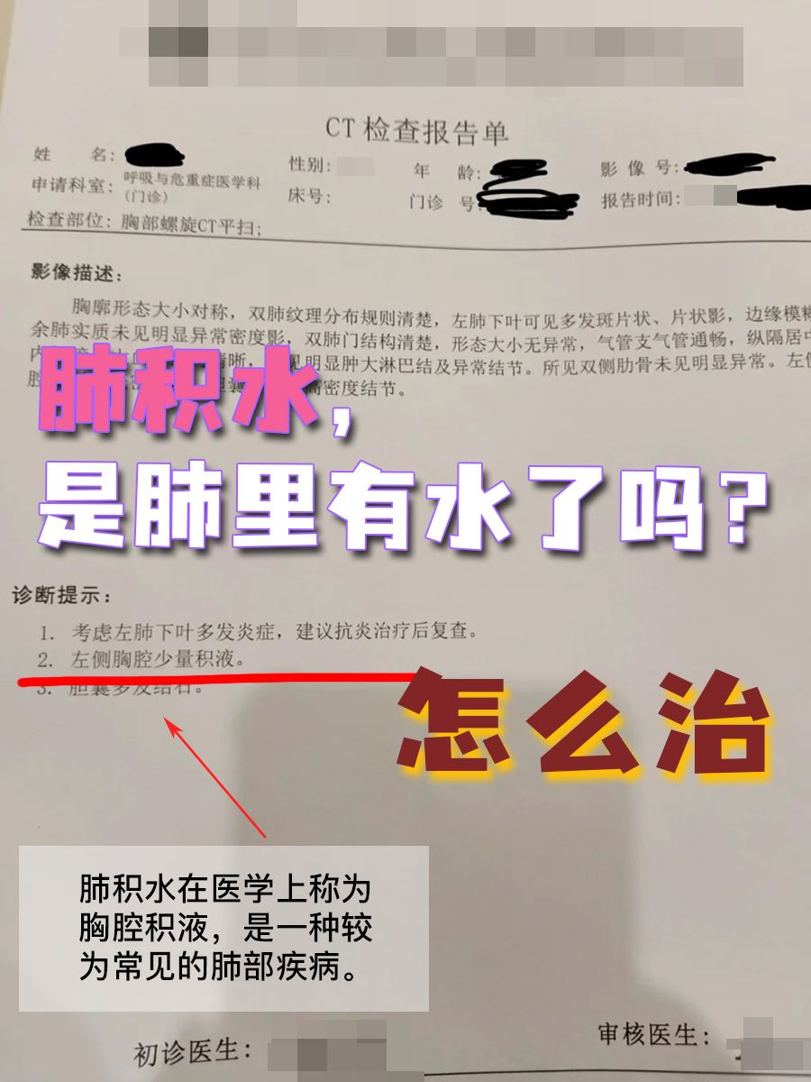 肺积水,是肺里有水了吗?怎么治