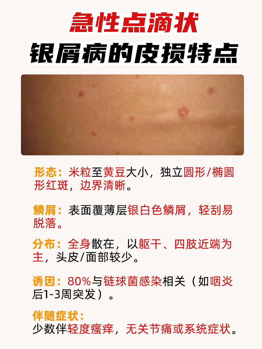 唯一能自愈的银屑病是什么｜医生揭秘！
